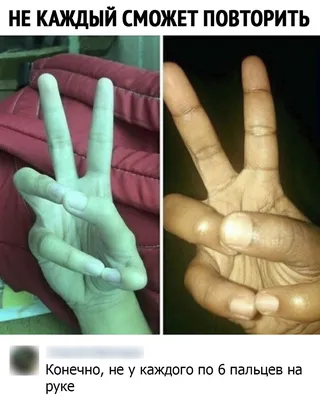 6 пальцев на руке: увеличенное изображение в формате JPG