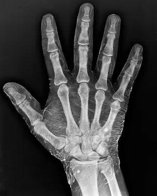 Фото руки с 6 пальцами: необычный случай на камеру