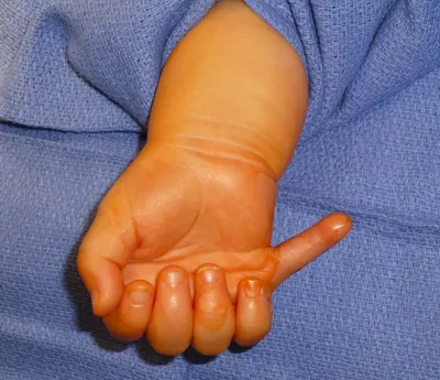 6 пальцев на руке: фото с высоким разрешением