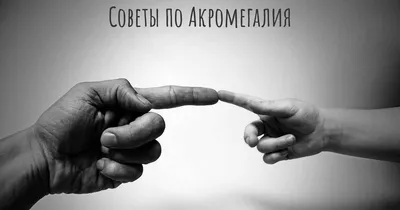 Акромегалия: патогенез, клиника, диагностика, методы лечения – тема научной  статьи по клинической медицине читайте бесплатно текст  научно-исследовательской работы в электронной библиотеке КиберЛенинка