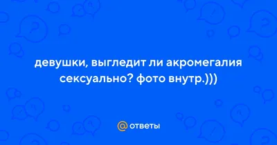 Что такое акромегалия и как её лечат - Лайфхакер