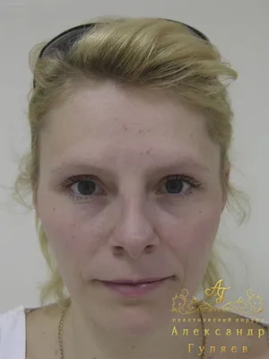 Юлия Колисниченко показала лицо после пластической операции - Вокруг ТВ.