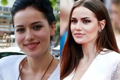 Александра Савельева обезобразила лицо пластической операцией – POPCAKE