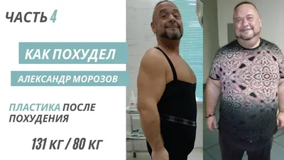 Александр Морозов признался, что похудел на 40 килограмм благодаря операции  » Звёзды.ru
