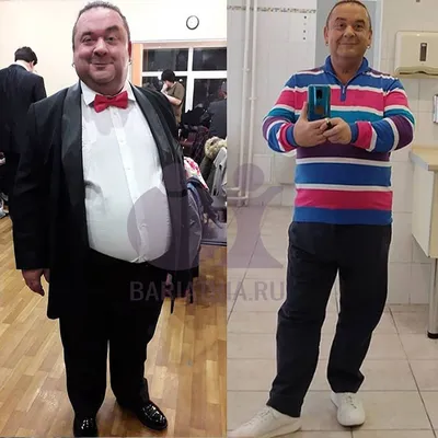 Артист Александр Морозов похудел на 55 кг - Центр хирургии веса