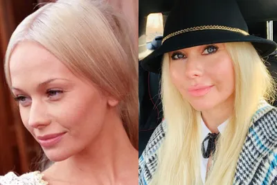 5 красивых российских актрис, внешность которых испортилась после  пластических операций - Рамблер/женский