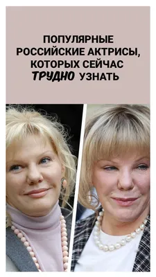 Сделанные» лица: 5 российских актрис, которые потеряли «изюминку» после  пластики