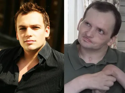 Новые фото пережившего обширный инсульт Алексея Янина: актер 8 лет прикован  к инвалидному креслу | STARHIT