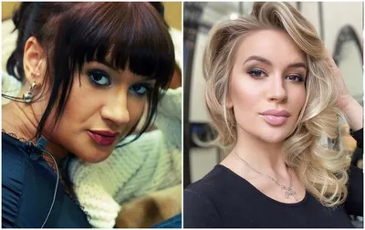 Экс-участница «Дома-2» Алена Водонаева рассказала о своих косметологических  инъекциях - KP.RU