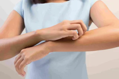 Аллергические пятна на руках: смотрите фото и узнайте больше