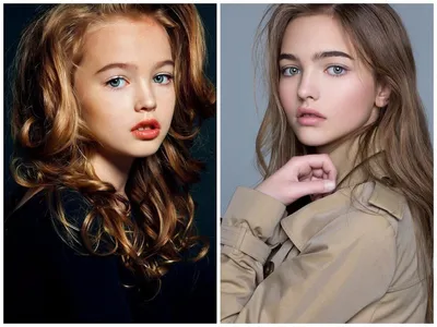 Как изменились 5 самых красивых детей мира | Anna Secret | Дзен