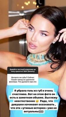 Анастасия Решетова призналась, как изменилась ее внешность из-за  гормонального сбоя