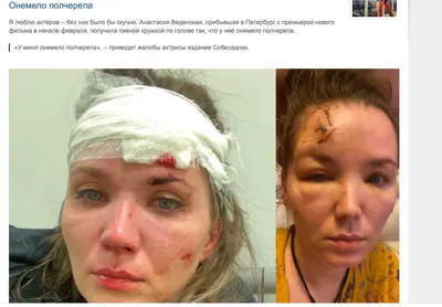 Анастасия Веденская рассказала о невозможности получить медицинскую помощь  в российских поездах