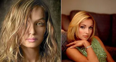 Анастасия Волочкова до и после пластики – фото в молодости и сейчас