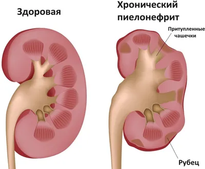 Как работают наши почки. Часть 1. | Пикабу