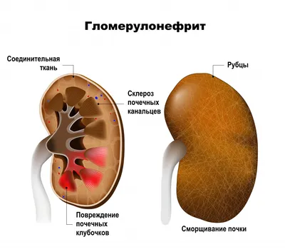 Почки человека: где находятся, как выглядят и работают, почему могут болеть