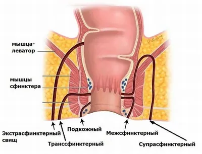 Рак тонкого кишечника: симптомы, признаки, диагностика, лечение