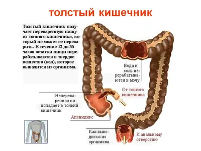 Свищ толстой кишки — surgery-first.ru