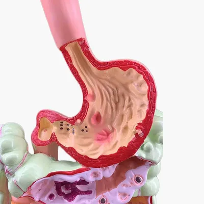 Пищеварительная система : нормальная анатомия | e-Anatomy