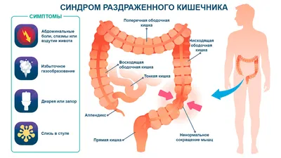 Операция по удалению опухоли в прямой кишке. - Хирург К. В. Пучков