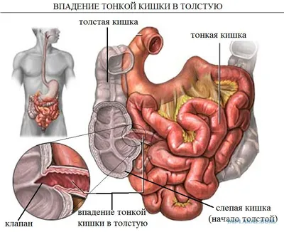 Рак прямой кишки — первые признаки и симптомы, лечение онкологии прямой  кишки в Москве