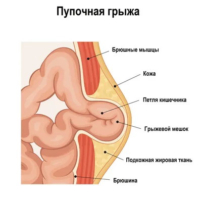 Прямая кишка картинки (49 фото) » Юмор, позитив и много смешных картинок