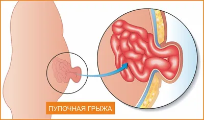 Позвоночник человека - анатомия, позвонки, изгибы и отделы