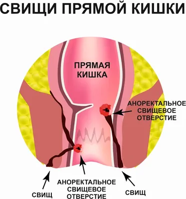 Брыжейка: структура, функции и её роль в развитии заболеваний