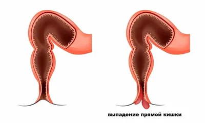 Пищеварительная система : нормальная анатомия | e-Anatomy