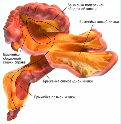 Полипы толстой кишки: отвечаем на вопросы пациентов