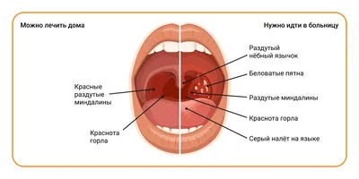 Ангина: истории из жизни, советы, новости, юмор и картинки — Все посты,  страница 2 | Пикабу