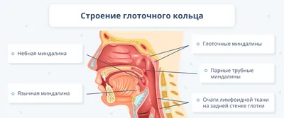 Лечение ангины у взрослых и детей - симптомы и причины