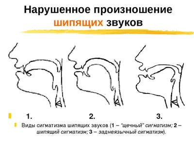 Артикуляционная гимнастика для звуков Ш и Ж | Дефектология Проф