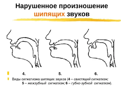 Артикуляционная гимнастика «Волшебные облака» (2 фото). Воспитателям  детских садов, школьным учителям и педагогам - Маам.ру