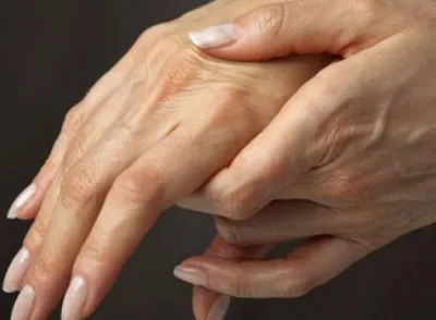 Фото артрита большого пальца руки: детальные изображения