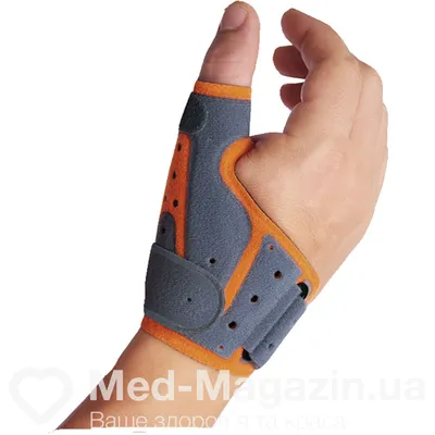 Изображение артрита кисти рук с подписью Как выглядит артрит