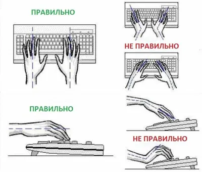 Изображение артрита кисти руки в низком разрешении