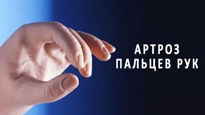 Фотка артроза большого пальца руки с эффектом размытия