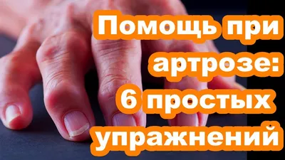 Фотографии артроза пальцев рук: причины возникновения болезни