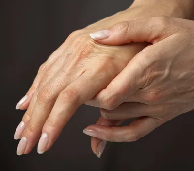 Изображения артроза пальцев рук: как понять, что болезнь начинается
