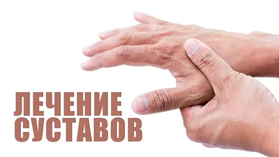 Артроз пальцев рук: фото и рекомендации врачей
