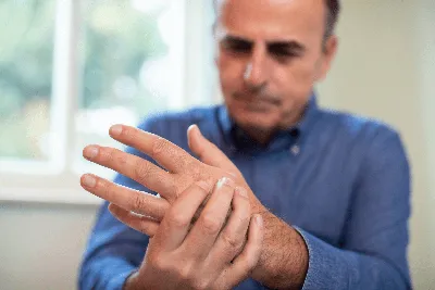 Фото артроза пальцев рук: симптомы и лечение