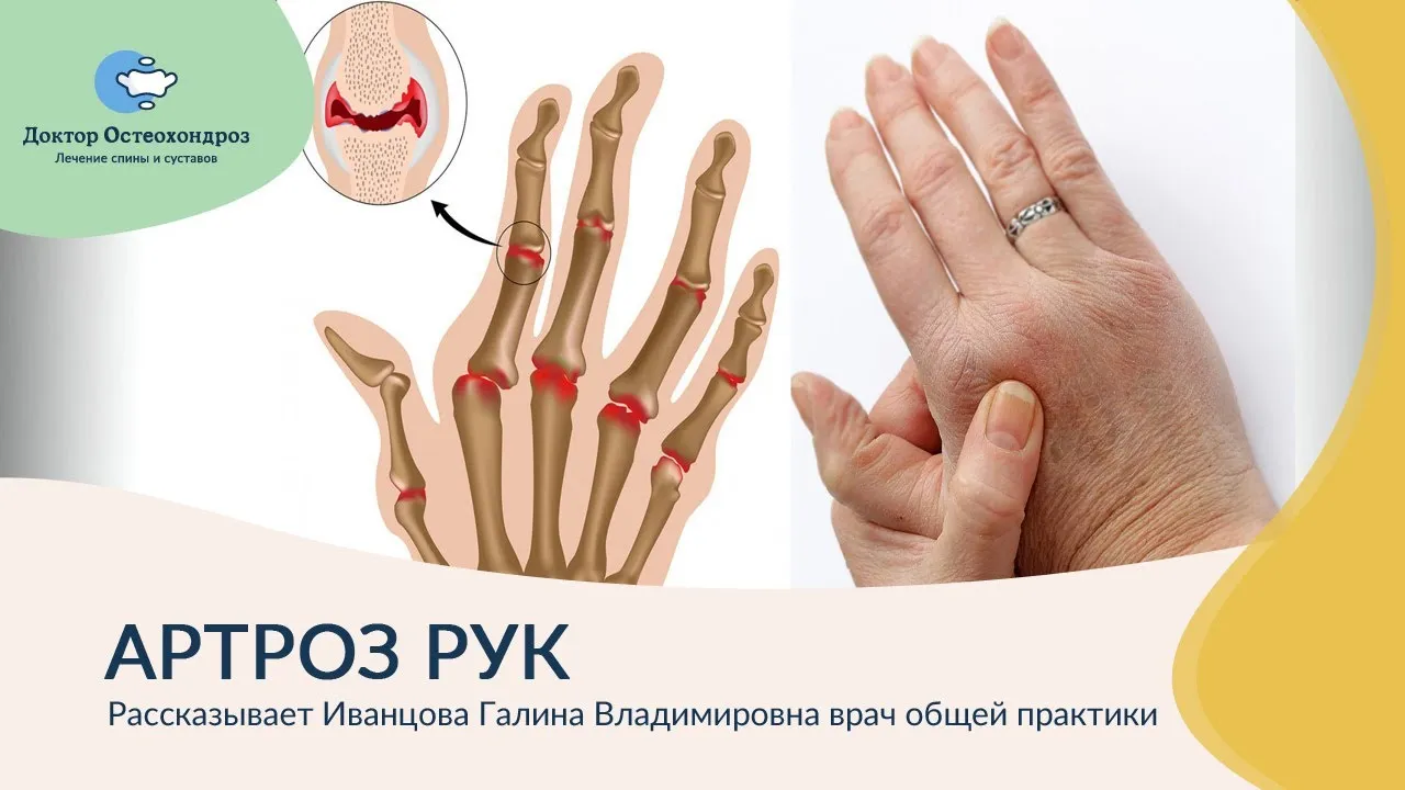 Болят суставы пальцев рук к какому врачу