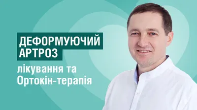 Изображение руки с артрозом: JPG формат