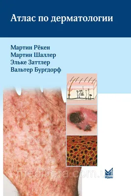 Брыжейка: структура, функции и её роль в развитии заболеваний