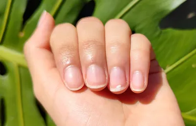Изображение белых пятен на ногтях рук