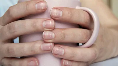 Фото белых пятен на ногтях рук в формате WebP