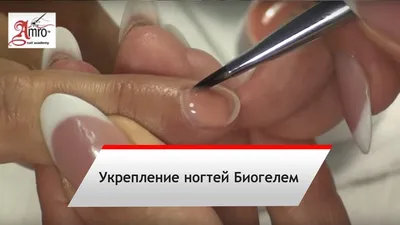 Картинка белых пятен на ногтях рук: причины и лечение