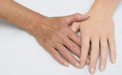 Биоревитализация рук: современные методы ухода за кожей