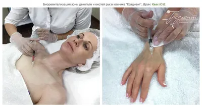 Биоревитализация рук: увлажнение и омоложение кожи на фото